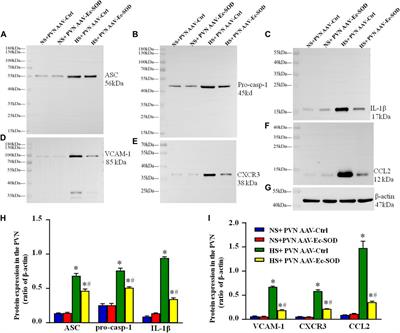 Bilateral Paraventricular Nucleus Upregulation of Extracellular Superoxide Dismutase Decreases Blood Pressure by Regulation of the NLRP3 and Neurotransmitters in Salt-Induced Hypertensive Rats